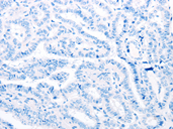 Валидация AssayVector ARM1735(2090)