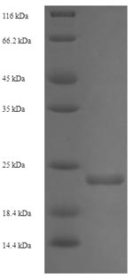 SDS-PAGE