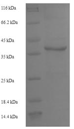 SDS-PAGE