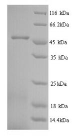 SDS-PAGE