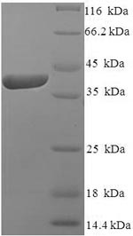 SDS-PAGE