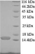 SDS-PAGE