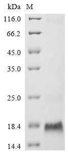 SDS-PAGE