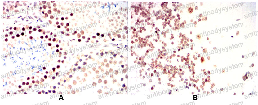 Валидация AntibodySystem RHG96902