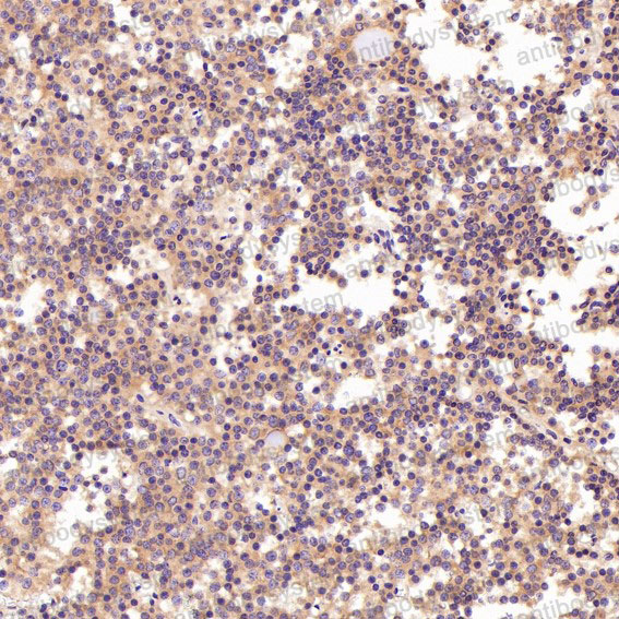 Валидация AntibodySystem RHN60301 (3839)