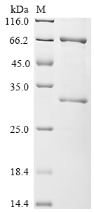 SDS-PAGE