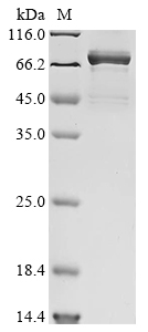 SDS-PAGE