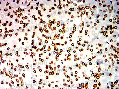 Валидация AntibodySystem RHD40903