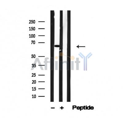 Валидация Affinity AF4741 - 2360