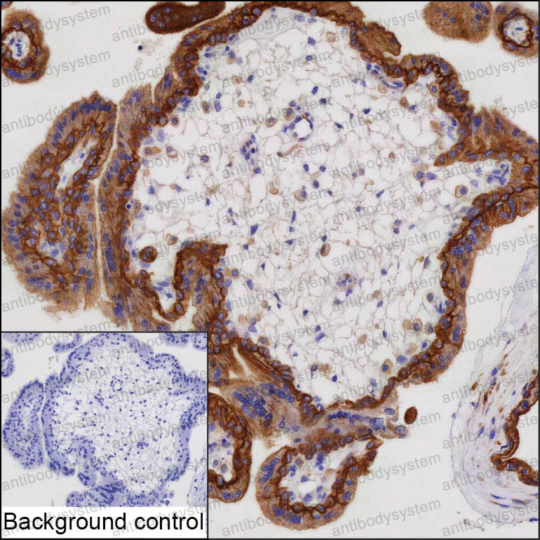 Валидация AntibodySystem RHP08201