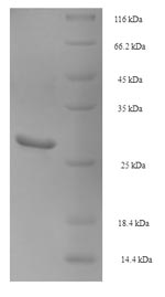 SDS-PAGE