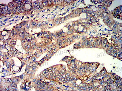 Валидация AntibodySystem RHE14008