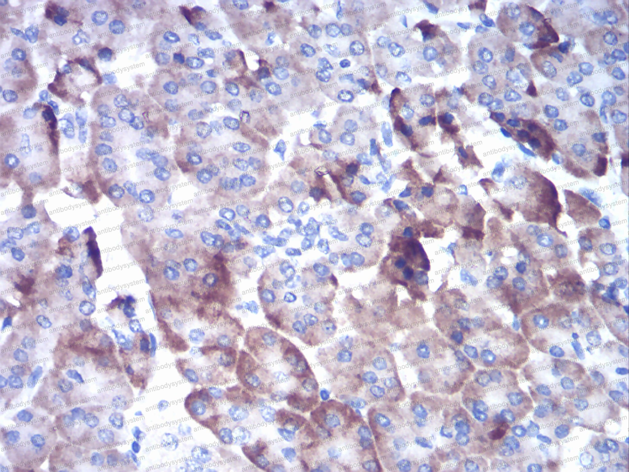 Валидация AntibodySystem RHC25303