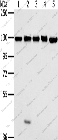 Вестерн-блоттинг, MATR3, клеточные линии NIH/3T3, 231, HeLa, K562 и 293T
