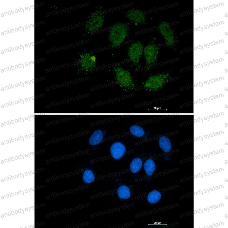 Валидация IF - AntibodySystem RHF75504