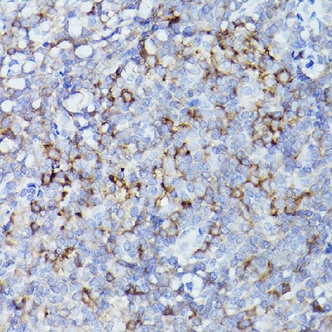 Иммуногистохимия, HLA-DQB1, ткань миндалин человека