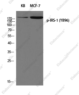 Вестерн-блоттинг, Phospho-IRS1 (Tyr896), клетки KB и MCF7