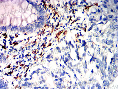 Валидация AntibodySystem RHD55204