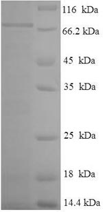 SDS-PAGE