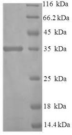 SDS-PAGE