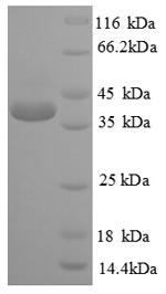 SDS-PAGE
