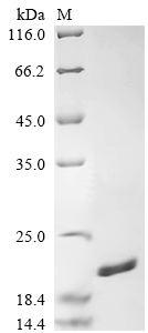 SDS-PAGE