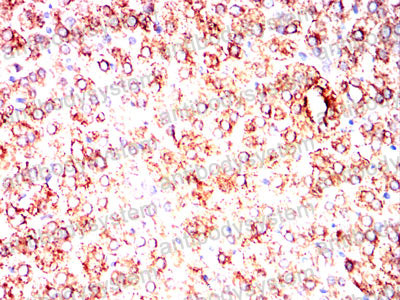 Валидация AntibodySystem RHN06803