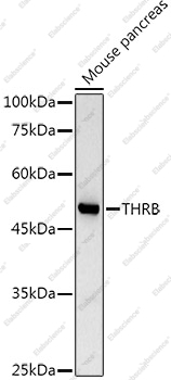 Вестерн-блоттинг, TRβ1/THRB, ткань поджелудочной железы мыши