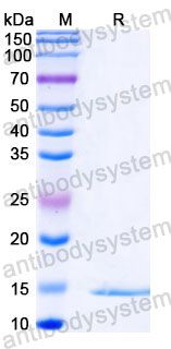 Валидация SDS-PAGE - AntibodySystem RWK80702