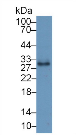 19000