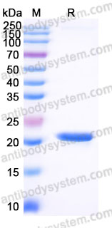 YHF41703, SDS-PAGE