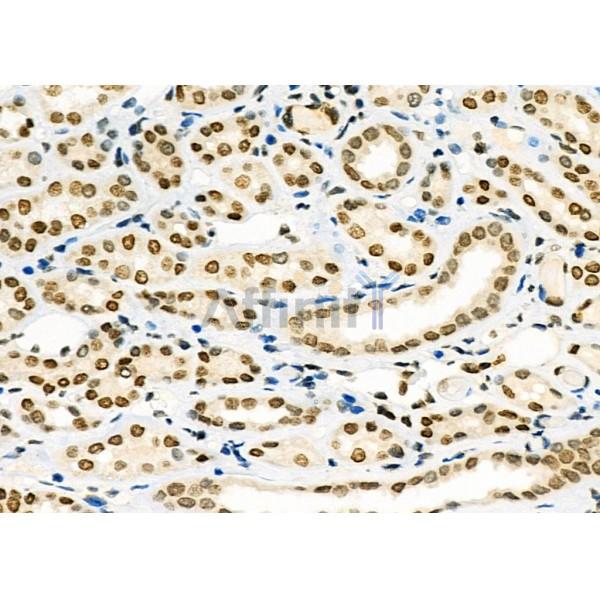 Валидация Affinity DF8831 - 20898