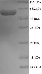 SDS-PAGE