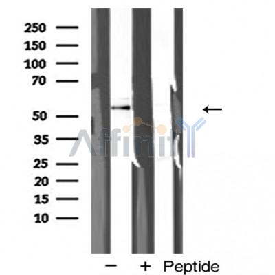 Валидация Affinity AF5158 - 2561