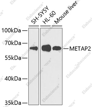 Вестерн-блоттинг, METAP2, различные клеточные линии
