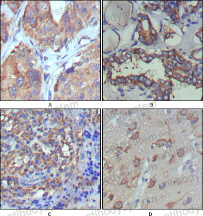 Валидация AntibodySystem RHE30702