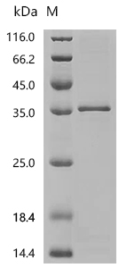 SDS-PAGE