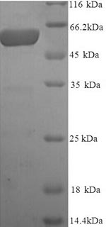 SDS-PAGE