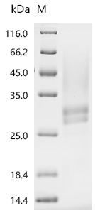 SDS-PAGE