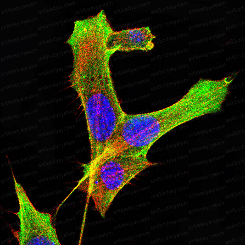Валидация IF - AntibodySystem RHF36801