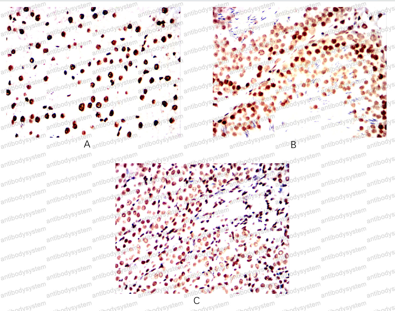 Валидация AntibodySystem RHE37704 (2126)