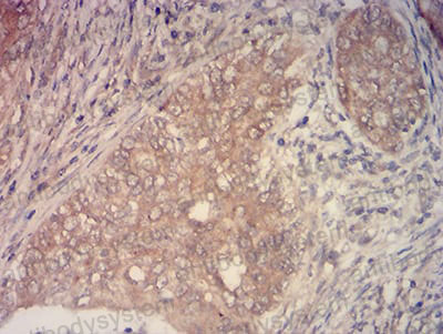 Валидация AntibodySystem RHN97202