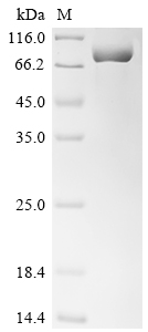 SDS-PAGE