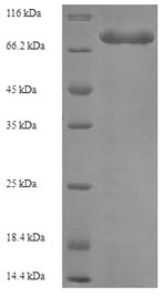 SDS-PAGE