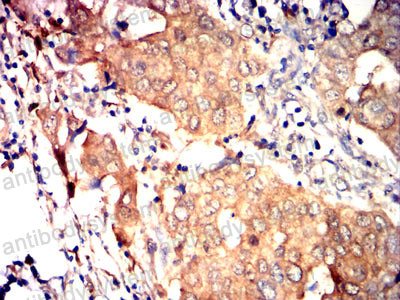 Валидация AntibodySystem RHD06601