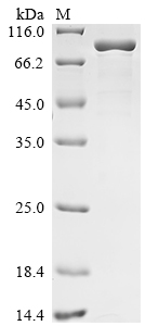 SDS-PAGE