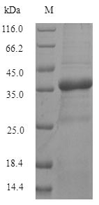 SDS-PAGE