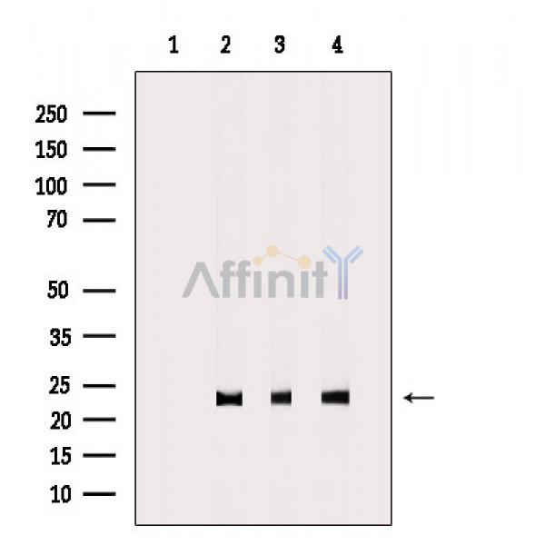 Валидация Affinity AF9119 - 4903