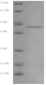 SDS-PAGE