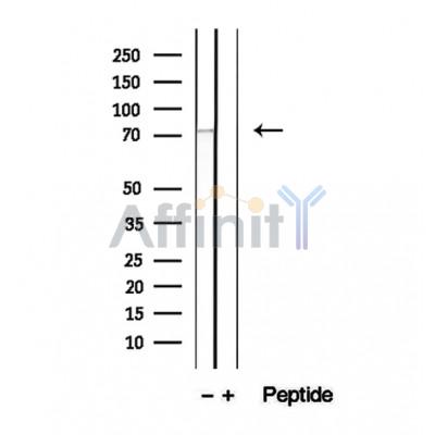 Валидация Affinity DF12418 - 6919